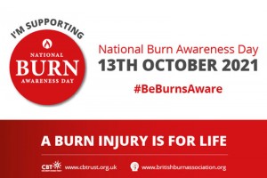 National Burn Awareness Day 2021!